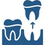 Wisdom Tooth Extractions