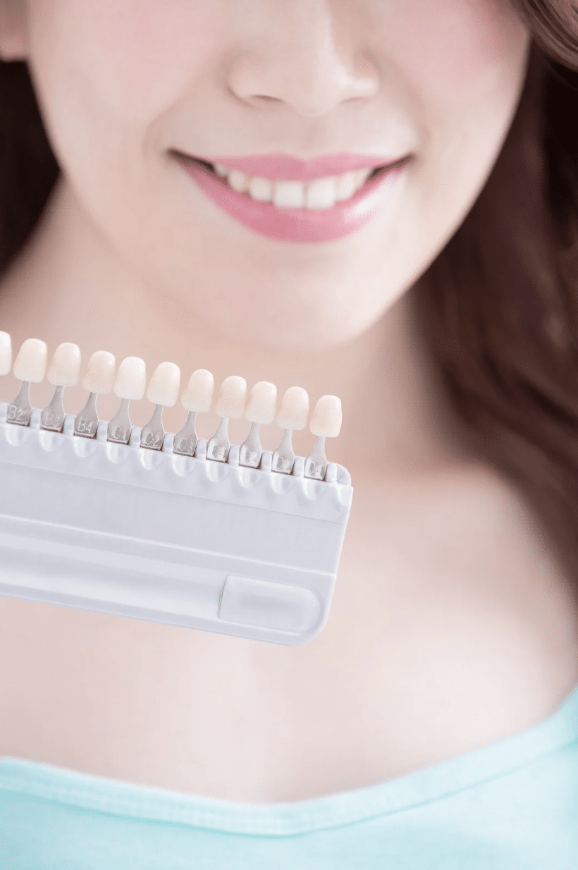 Professional teeth whitening at Meiplus Dentalcare Singapore
