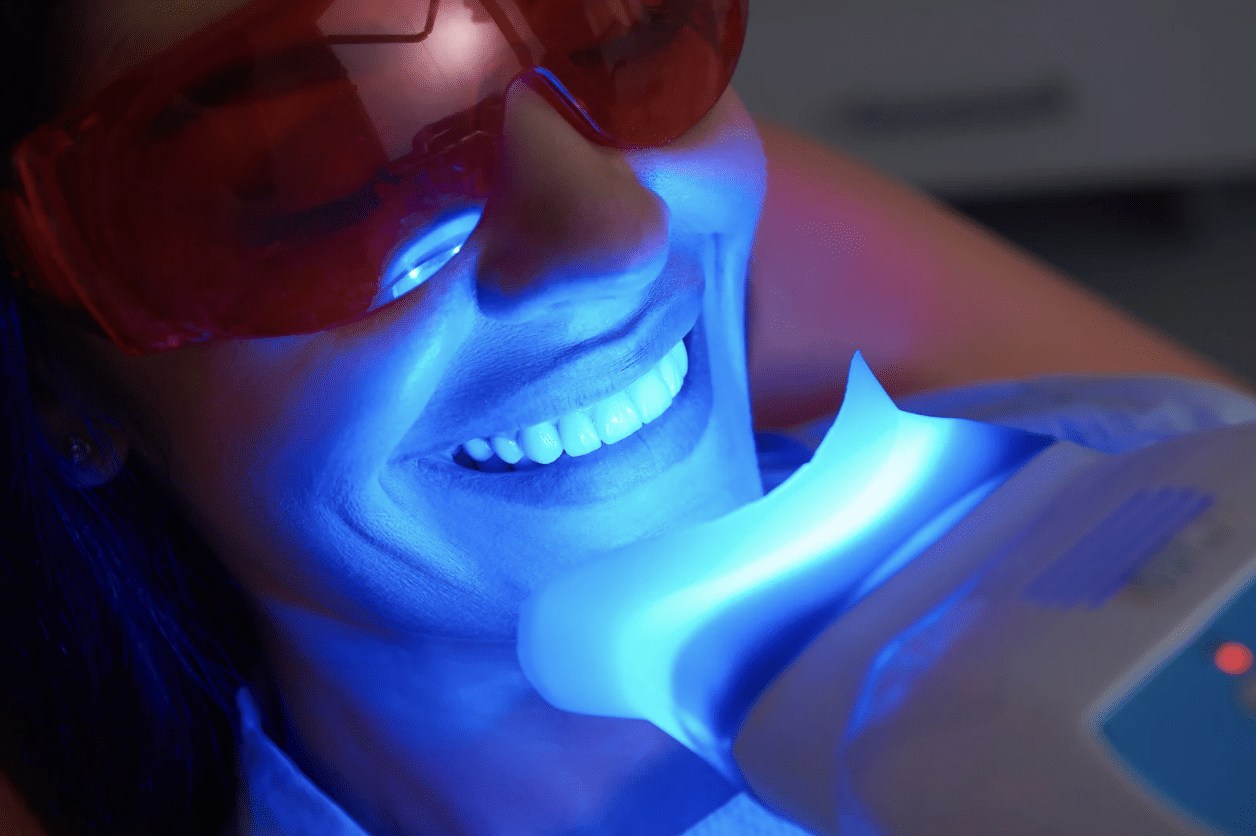 LED whitening light used during teeth whitening treatment