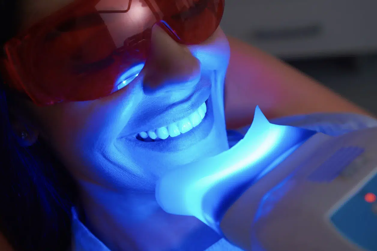 LED whitening light used during teeth whitening treatment
