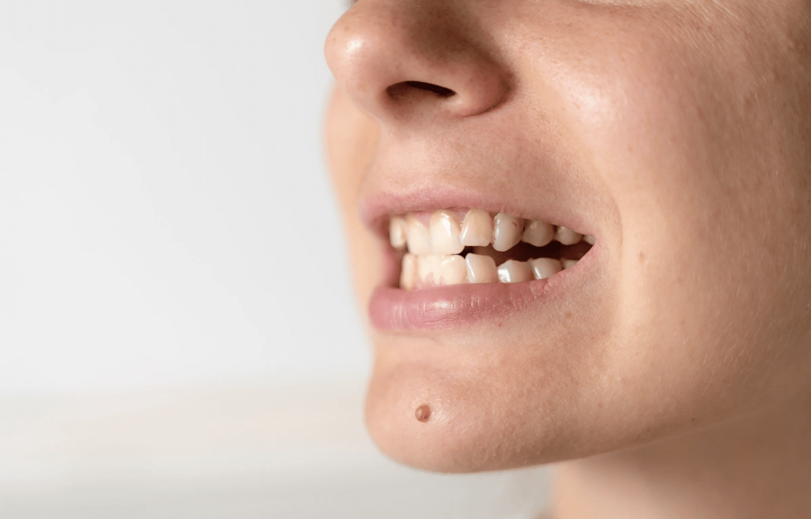 Speech and chewing affected by crooked teeth