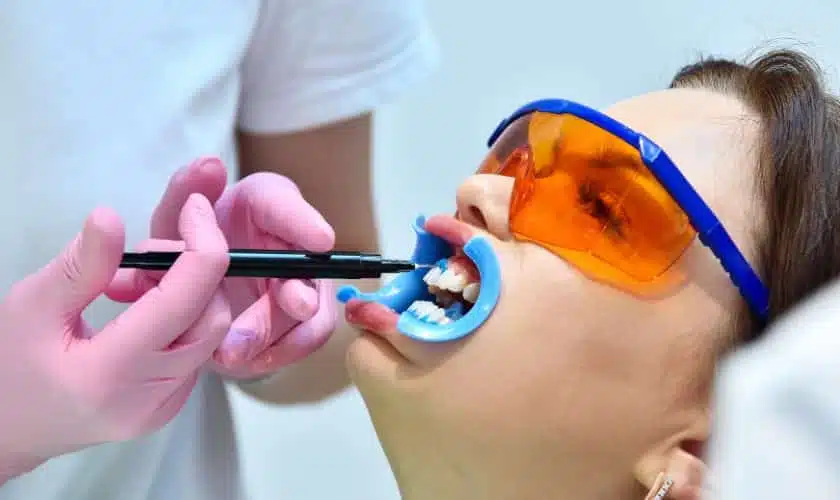 Protective barrier applied to the gums and lips before teeth whitening