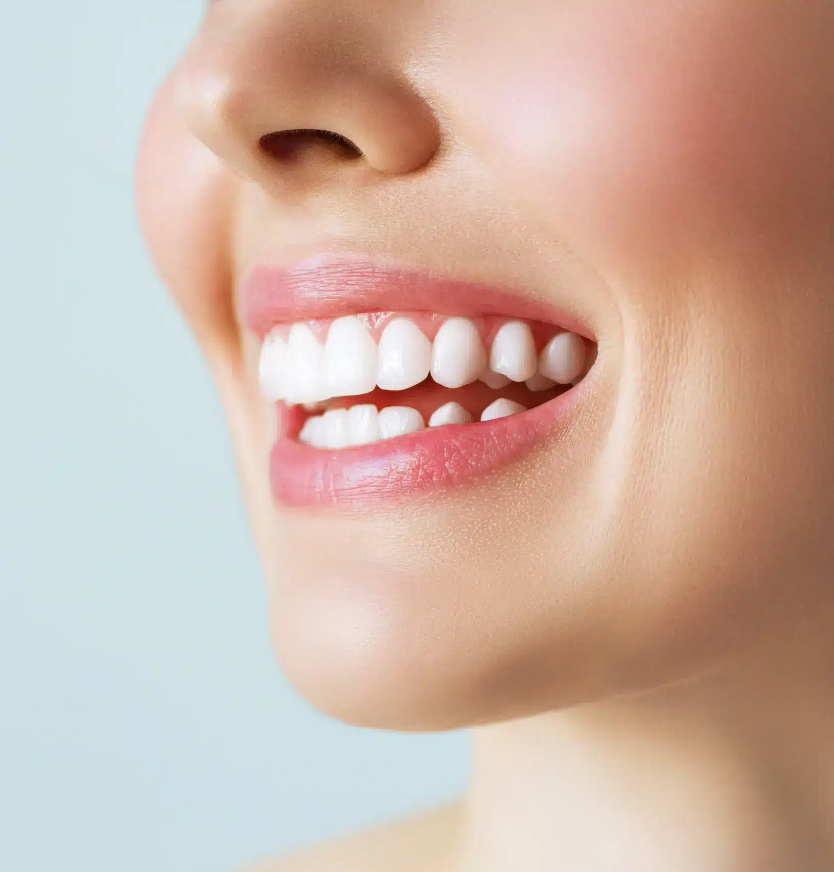 Straight, well-aligned teeth after orthodontic treatment