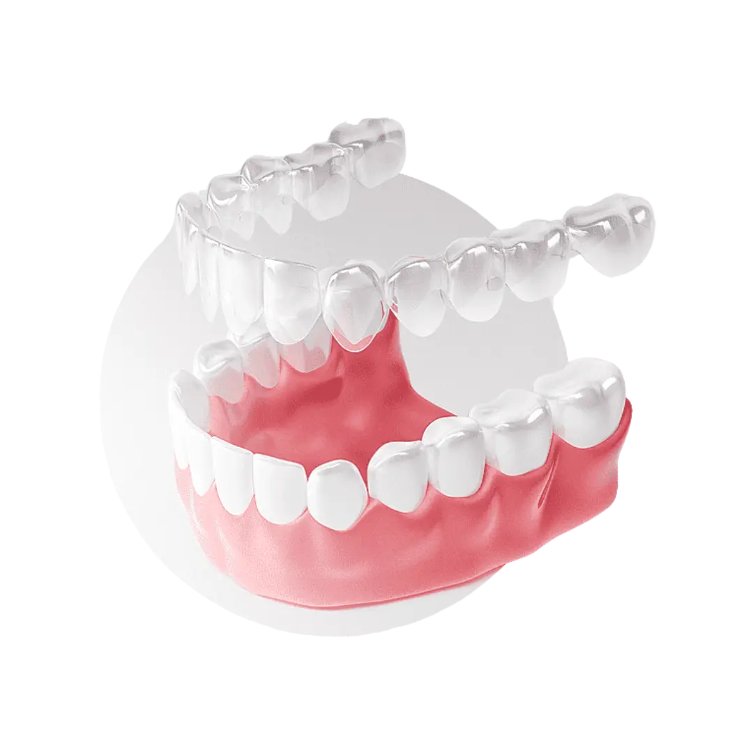 Invisalign teeth alignment as part of a smile makeover at Meiplus Dentalcare