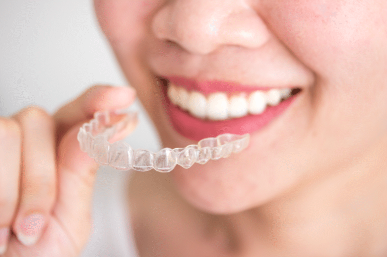 Invisalign Clear Aligner Treatment in Singapore