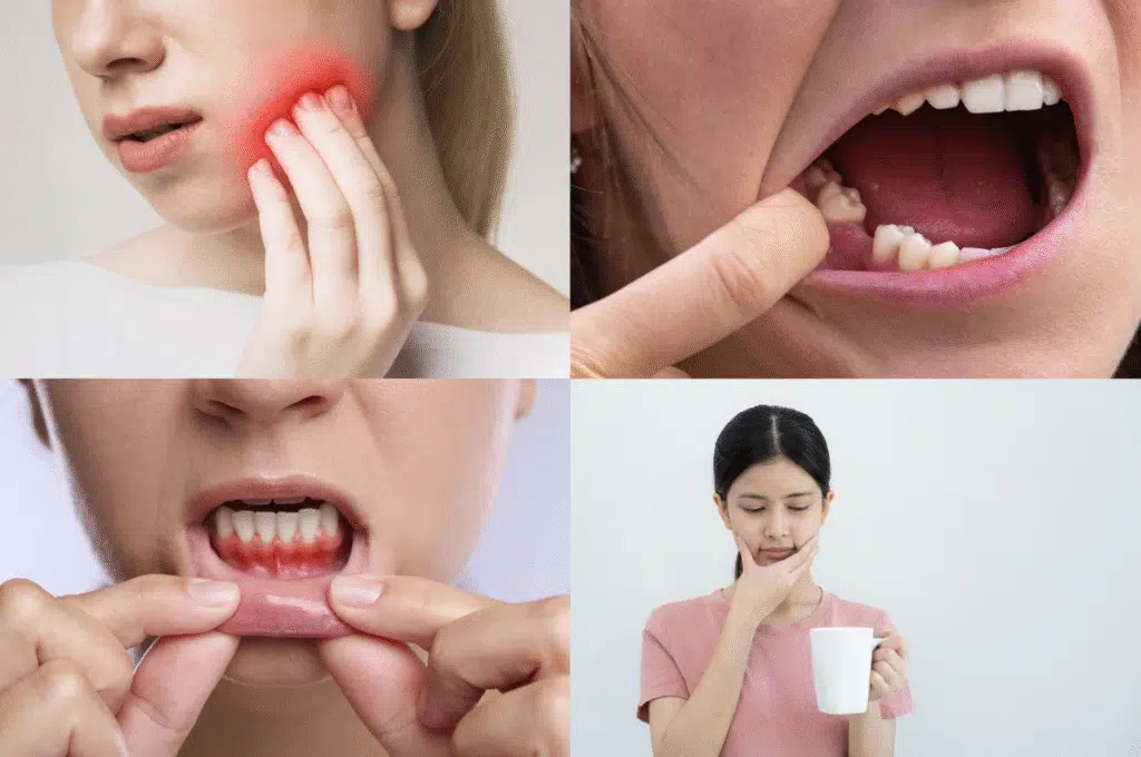 Common Signs that you need a root canal